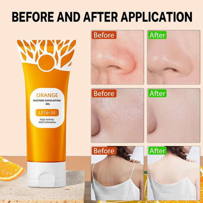 OrangeGlow™️ - Exfoliating Whitening Gel